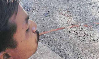 విశాఖలో కిడ్నీ రాకెట్ కలకలం