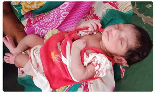 కుడివైపు గుండెతో పుట్టిన పాప..ఎంత క్యూట్గా ఉందో..