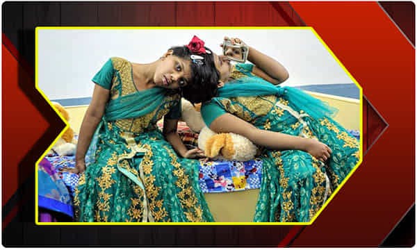 వీణావాణీలకు టెన్త్ ఎగ్జామ్స్..! హాల్ టికెట్స్ ఒకటా..? రెండా..?