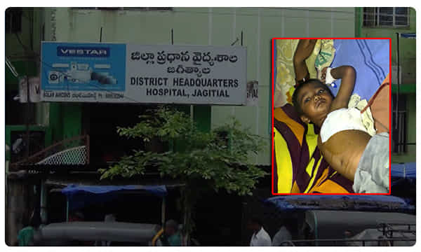 జగిత్యాల ప్రభుత్వాస్పత్రిలో అరుదైన ఆపరేషన్