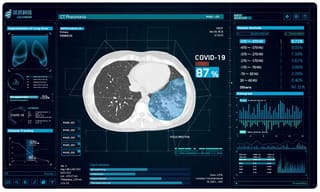 కోవిడ్-19 ఎఫెక్ట్.. ఇక ఇళ్ల నుంచే పని చేయండి.. సిబ్బందికి ట్విటర్ ఆదేశం