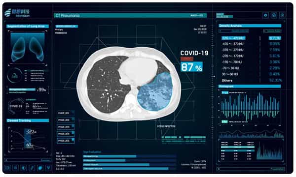 Artificial intelligence: ఆ పరికరం కరోనావైరస్ను క్షణాల్లో కనిపెడుతుందట...