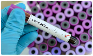 గుంటూరులో లాక్ డౌన్ ఉల్లంఘిస్తే వెరైటీ పనిష్మెంట్..ఇలా చేస్తే ఎవ్వ‌రూ బ‌య‌ట‌కి రారు…