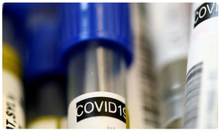 తెలుగు రాష్ట్రాల్లో ఉధృతంగా విజృంభిస్తోన్న కరోనా.. ఏపీలో ఏకంగా..