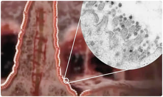 ఎయిమ్స్‌ బిల్డింగ్‌ నుంచి దూకిన కరోనా జర్నలిస్టు.. చికిత్స పొందుతూ మృతి..