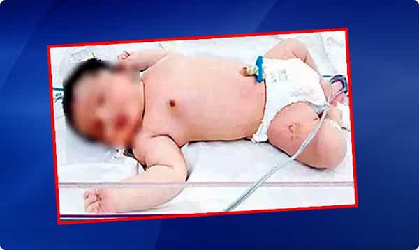 నిర్మల్లో బాల భీముడు.. ఐదున్నర కిలోలతో జననం