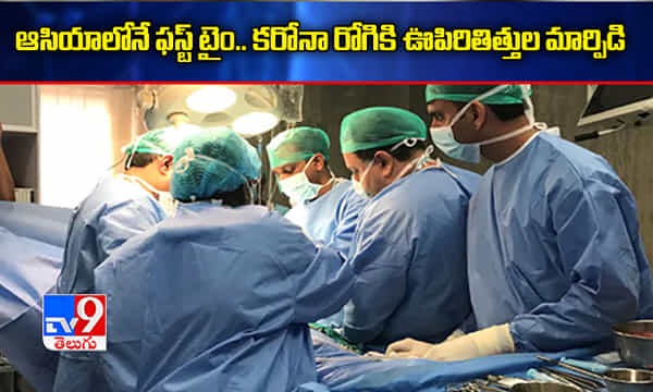 ఆసియాలో ఫస్ట్ టైం: కోవిడ్ రోగికి ఊపిరితిత్తుల మార్పిడి
