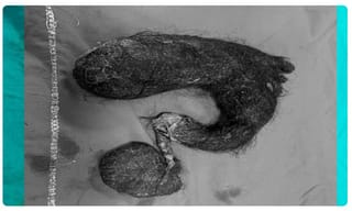 ఢిల్లీలో 1192 కరోనా పాజిటివ్ కేసులు, 23 మంది మృతి!