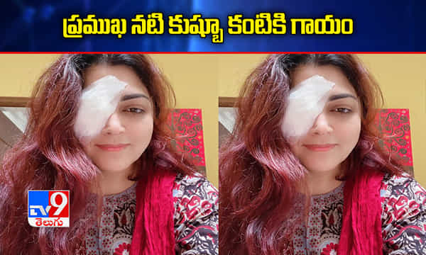Kushboo Eye Injury : ప్రముఖ నటి కుష్బూ కంటికి గాయం