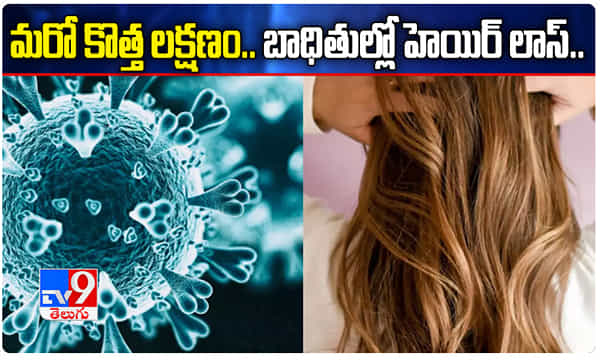 మరో కరోనా లక్షణం.. బాధితుల్లో హెయిర్ లాస్..!