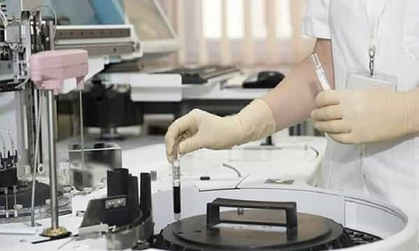 ఏపీలో కొవిడ్ సిరో సర్వైలెన్స్