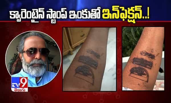 క్వారెంటైన్ స్టాంప్ ఇంక్తో ఇన్ఫెక్షన్!