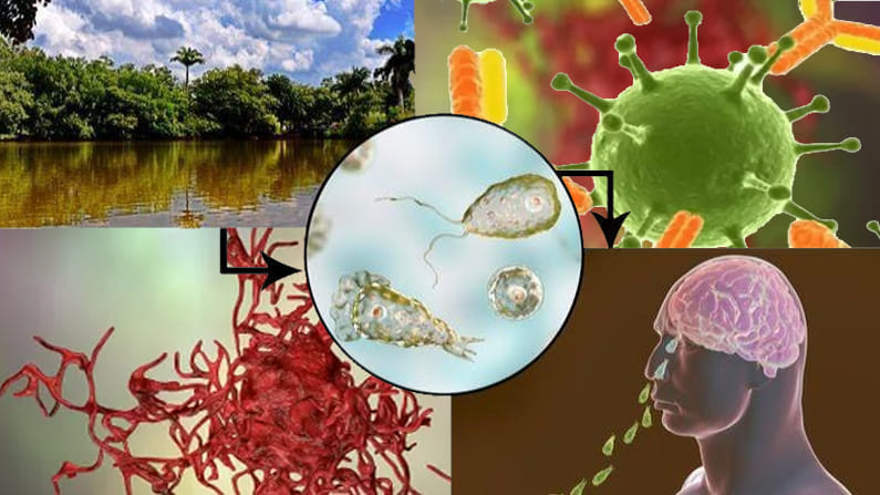 Brain eating amoeba: మెదడు తినే అమీబా.. భయభ్రాంతులకు గురి చేస్తున్న మరో సూక్ష్మజీవి