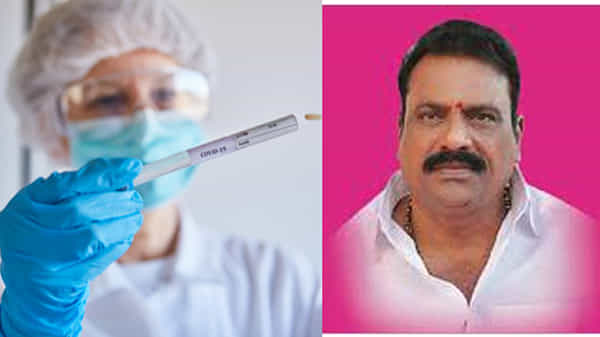 రాజేంద్రనగర్ ఎమ్మెల్యే ప్రకాష్ గౌడ్ కు కరోనా పాజిటివ్, పరామర్శలు వద్దని వినతి