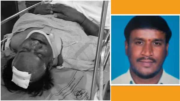 Clashes: ఉప్పర్పల్లిలో తీవ్ర ఉద్రిక్తత.. ప్రహరీ విషయంలో ఇరు కుటుంబాల మధ్య ఘర్షణ.. తీవ్రంగా గాయపడిన వ్యక్తి..