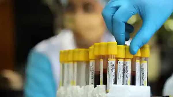 Corona Virus Threat: కరోనా ముప్పు వీరికి వచ్చే ఛాన్స్లు చాలా తక్కువట.. షాకింగ్ విషయాలు వెల్లడించిన సీరో సర్వే..