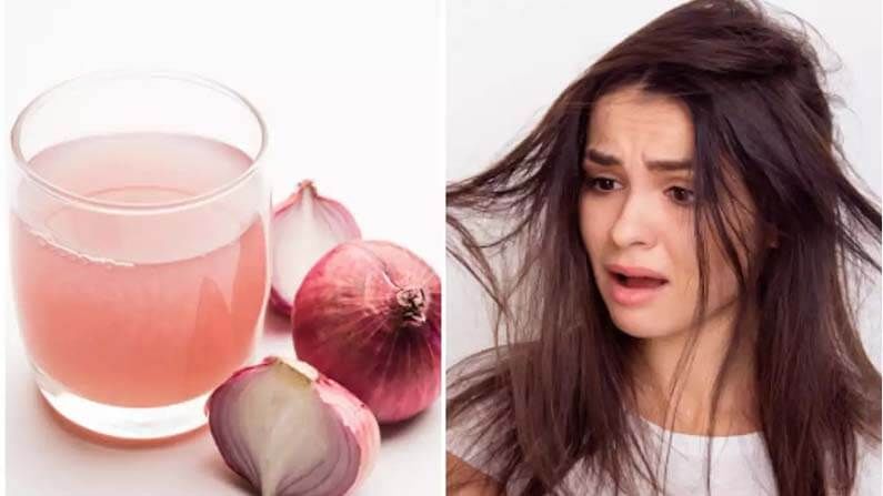 Hair Protect Tips in home: మీ జుట్టు ఎక్కువగా రాలిపోతుందా ? మీ ఇంట్లో ఉండే ఉల్లిపాయలతో ఇలా ట్రై చేయండి..