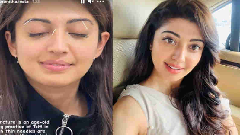 Pranitha Subhash : మొహానికి సూదులు గుచ్చుకున్న హీరోయిన్.. సోషల్ మీడియాలో వైరల్ అవుతున్న ఫోటో