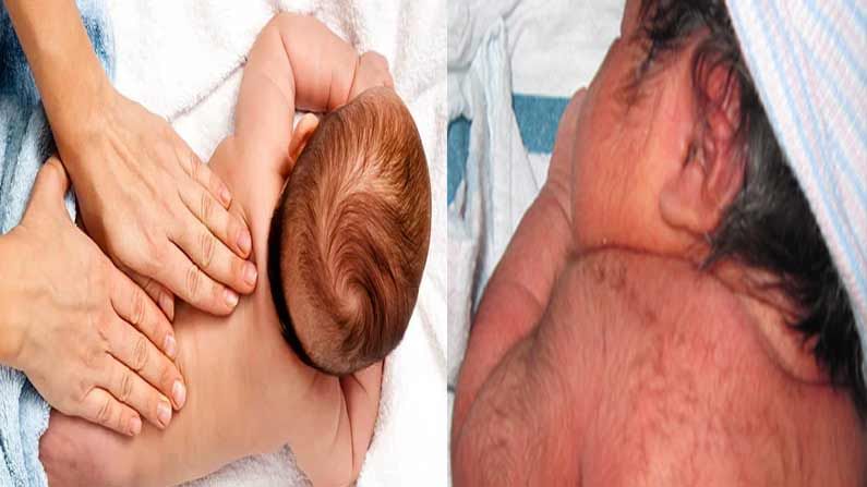 Natural Hair Removal: చిన్నారి శరీరంపై జట్టుని తొలగించడానికి సహజమైన, సురక్షితమైన పద్ధతులు ఏమిటంటే..?