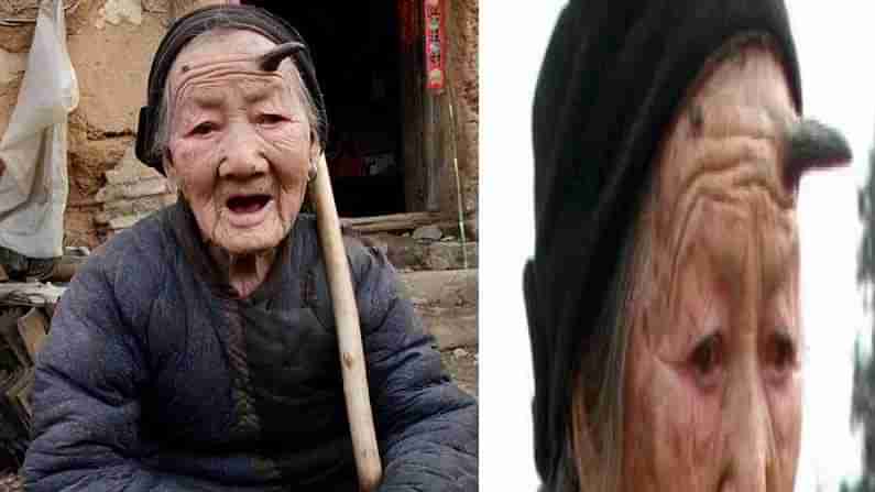 Devil Horns Grandmother : ప్రపంచంలోనే విచిత్ర మహిళ.. ఈ బామ్మాగారి నుదిటి మీద జంతువులా కొమ్ములు