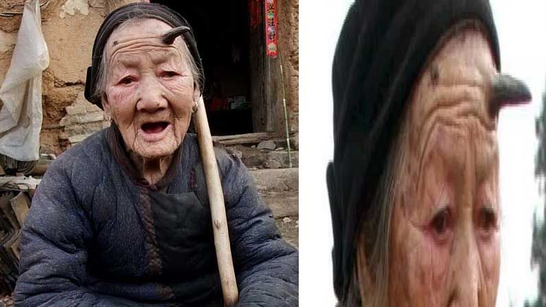 Devil Horns Grandmother : ప్రపంచంలోనే విచిత్ర మహిళ.. ఈ బామ్మాగారి నుదిటి మీద జంతువులా కొమ్ములు