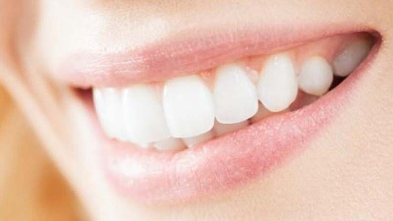 Teeth Whitening Tips: ప్రతిఒక్కరూ నవ్వుతుంటే.. చాలా అందంగా ఉంటుంది. అయితే వారి ముఖంతోపాటు పళ్లు కూడా అందానికి మరింత ఆకర్షణీయంగా మారుతాయి. అయితే కొంతమంది పళ్లు చూడటానికి గార పట్టి లేదా పసుపు రంగులో ఉంటాయి. అలాంటి వారు నవ్వుతారు. కానీ బయటకు కనిపించేలా నవ్వరు.