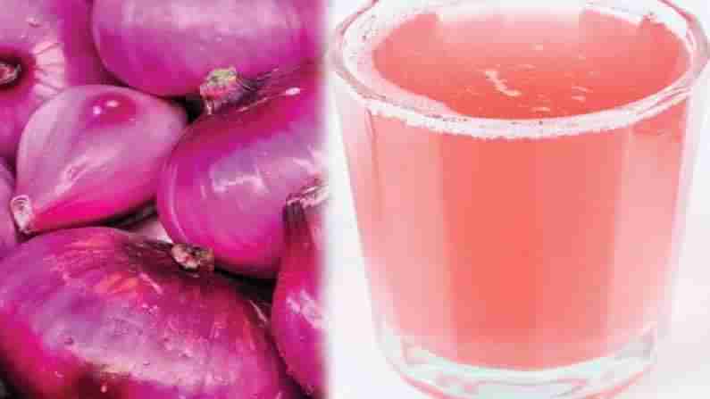 Onion Juice for Hair: జుట్టు రాలడం సమస్యతో బాధపడుతున్నారా ?.. డోంట్ వర్రీ.. పరిష్కారం ఇదిగో..!