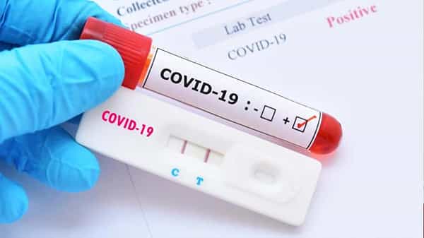 Coronavirus: తిరుమల వేద పాఠశాలలో కరోనా కలకలం.. మరి కొంతమంది విద్యార్థులకు పాజిటివ్