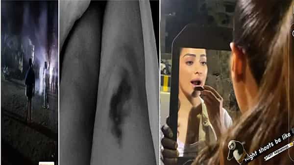 Raai Lakshmi Injured :షూటింగ్లో గాయపడిన మెగా ఐటెం భామ... క్వీన్ ఆఫ్ ఇంజురిస్ అంటూ పిక్స్ షేర్ చేసిన రాయ్ లక్ష్మి