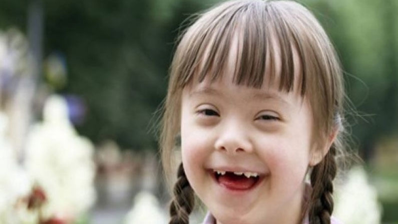World Down Syndrome Day 2021 : డౌన్ సిండ్రోమ్ అంటే ఏమిటి? దాని లక్షణాలు ఎలా ఉంటాయి.. ట్రీట్ మెంట్ గురించి తెలుసుకోండిలా..