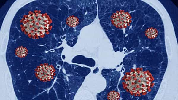 Coronavirus: కొవిడ్ నెగెటివ్ వచ్చినా ఊపిరితిత్తులపై కరోనా మచ్చలు... గుర్తించిన నిపుణులు..