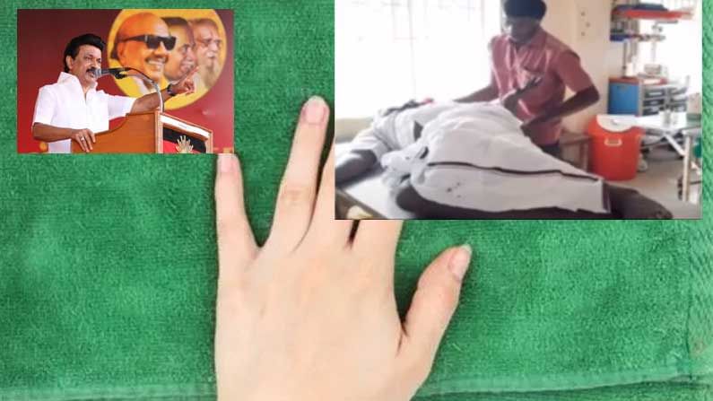 DMK Fan Cut off His Fingers: స్టాలిన్ సీఎం కావాలని చేతి వేళ్లు నరుకున్న డీఎంకే కార్యకర్త