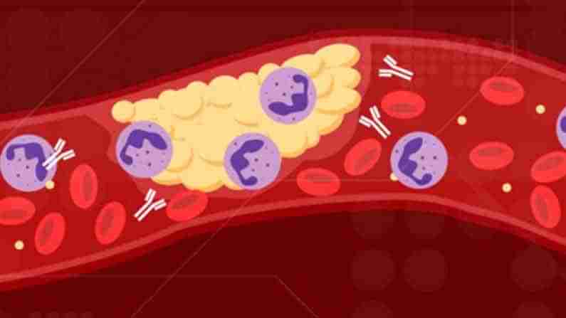 Blood Clots with COVID-19: కరోనా ఊపిరితిత్తుల వ్యాధి మాత్రమే కాదు..రక్తం గడ్డ కట్టే ప్రమాదకరమైన ఇబ్బందీ ఉంది