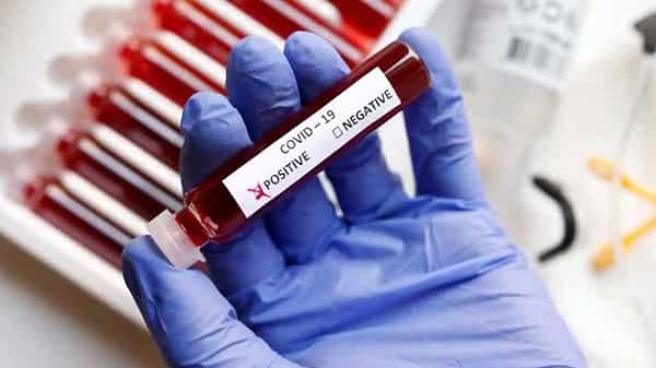 Telangana Corona Cases Updates: తెలంగాణలో మళ్లీ పెరిగిన కరోనా కేసులు.. కొత్తగా 6,876 కేసులు నమోదు..