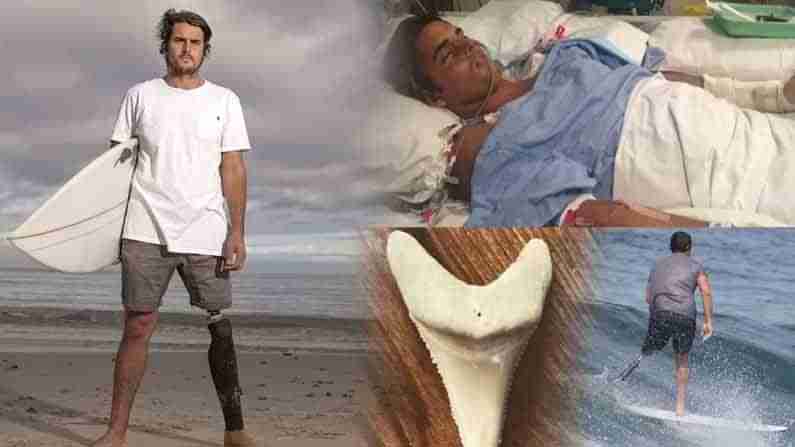 Shark Attack: తెల్ల సొరచేప దాడిలో కాలు కోల్పోయిన సర్ఫింగ్ క్రీడాకారుడు.. దానికి గుర్తుగా ఏం సాధించాడో తెలుసా?