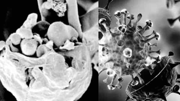 White fungus : ఆంధ్రప్రదేశ్లో వైట్ ఫంగస్ కలకలం.. కర్నూలు జిల్లా వెలుగోడు మండలంలో వ్యాధి నిర్ధారణ