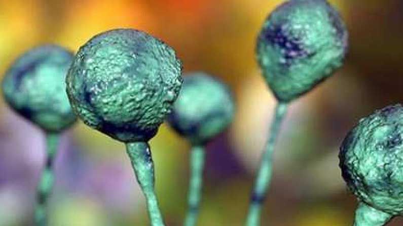 Black Fungus: తెలుగు రాష్ట్రాల్లో  బ్లాక్‌ఫంగస్‌ కేసులు.. శ్రీకాకుళం, ఖ‌మ్మం జిల్లాల్లో గుర్తింపు