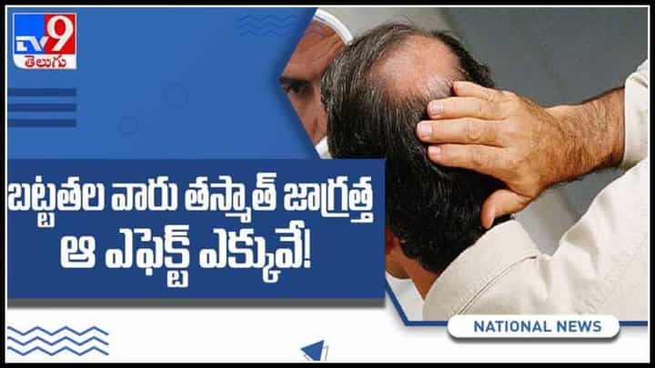 Hair loss video : బట్టతల వారు తస్మాత్ జాగ్రత్త…ఆ ఎఫెక్ట్ ఎక్కువే! జుట్టు రాలకుండా ఇలా చెయ్యండి ..(వీడియో). Hair loss video : బట్టతల వారు తస్మాత్ జాగ్రత్త…ఆ ఎఫెక్ట్ ఎక్కువే! జుట్టు రాలకుండా ఇలా చెయ్యండి ..(వీడియో).