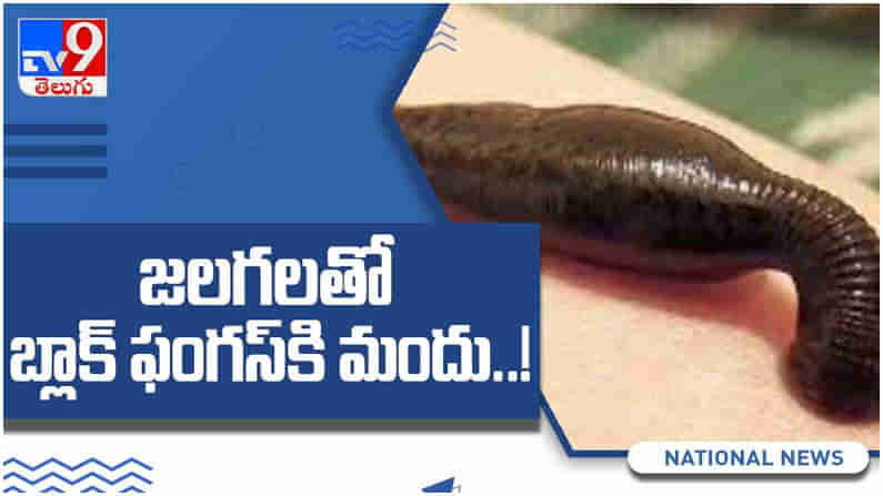 Leech Therapy: జలగలతో బ్లాక్ ఫంగస్‌కి మందు...ఎలా ఉపయోగిస్తారో తెలుసా..?? ( వీడియో )