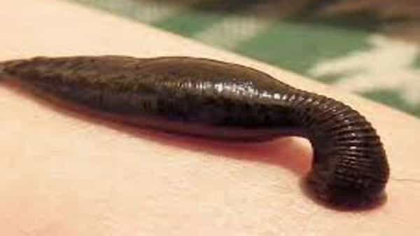Leech Therapy : జలగలతో బ్లాక్ ఫంగస్కి మందు..! వైద్యులు వీటిని ఎలా ఉపయోగిస్తారో తెలుసా..?
