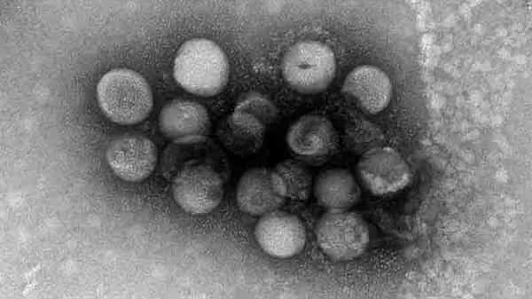 Two More Coronaviruses: మనుషులకు పొంచి ఉన్న మరో ముప్పు.. మరో రెండు వైరస్లను గుర్తించిన సైంటిస్టులు..?