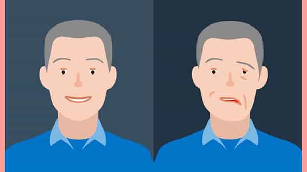 Bells Palsy: కరోనాతో మరో ముప్పు.. వైరస్ బారిన పడిన వారికి ముఖపక్షవాతం బెల్స్ పాల్సీ వచ్చే అవకాశం
