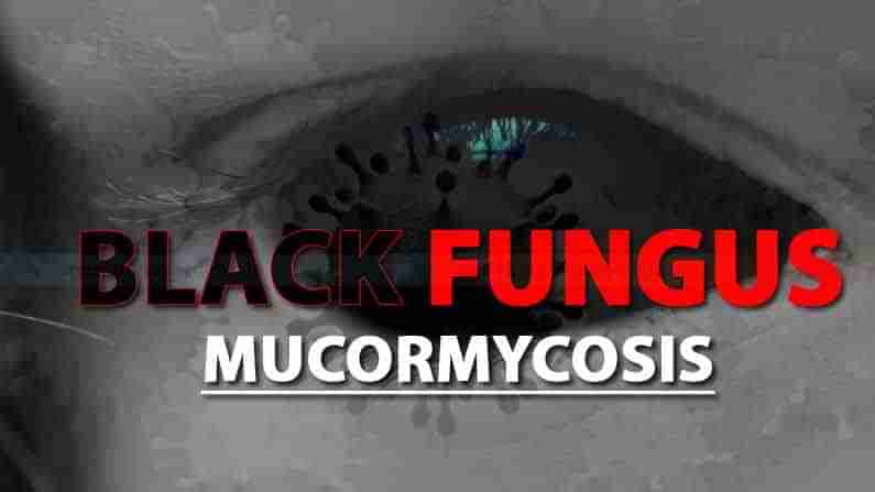 Black Fungus: బ్లాక్ ఫంగస్ కు చౌకైన వైద్య విధానం కనిపెట్టిన వైద్యులు..తక్కువ ఖర్చుతో మెరుగైన ఫలితం అంటున్న నిపుణులు