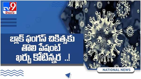 Black Fungus: బ్లాక్ ఫంగస్ చికిత్సకు తోలి పేషంట్ ఖర్చు ఎంతో తెలిస్తే షాక్ అవ్వాల్సిందే... ( వీడియో )