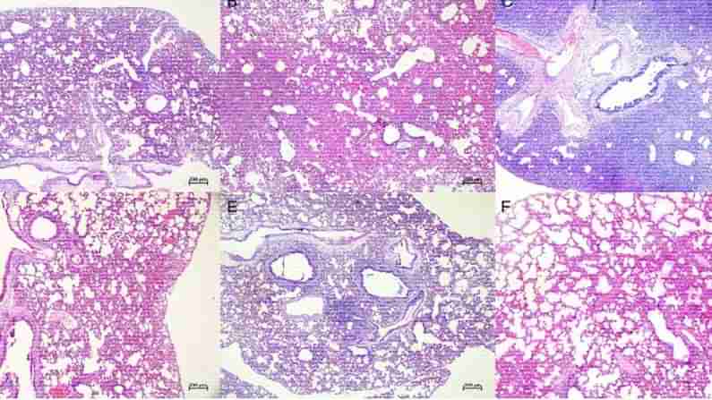 Coronavirus Variants: మరో డేంజరస్‌ వేరియంట్‌..ఏడు రోజుల్లో వెయిట్‌ లాస్‌ !..ఇవిగో వివ‌రాలు