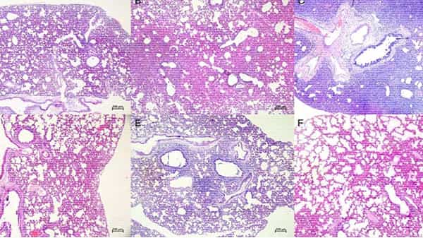Coronavirus Variants: మరో డేంజరస్ వేరియంట్..ఏడు రోజుల్లో వెయిట్ లాస్ !..ఇవిగో వివరాలు