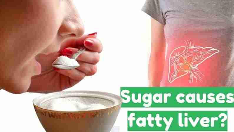 Fatty Liver: షుగర్ ఎక్కువ తీసుకుంటే ఫ్యాటీ లివర్ సమస్య ఎలా పెరుగుతుంది? పరిశోధకులు ఏం చెబుతున్నారు?