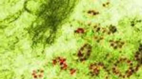 Green fungus: మరో టెన్షన్.. దేశంలో తొలిసారిగా గ్రీన్ ఫంగస్ కేసు నమోదు