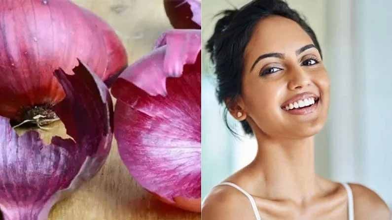 Onion Peel Benefits : ఉల్లిపాయ తొక్కలో అద్భుత ఔషధ గుణాలు..! ఆరోగ్యానికి అందమైన జుట్టుకోసం..