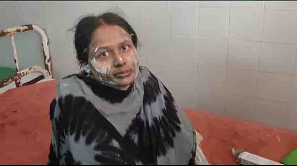 Parents Ablazed Daughter: రాయచోటిలో మరో పరువ హత్య.. ప్రేమించిన పాపానికి కూతురుపై ఘాతుకం.. చికిత్సపొందుతూ యువతి మృతి!